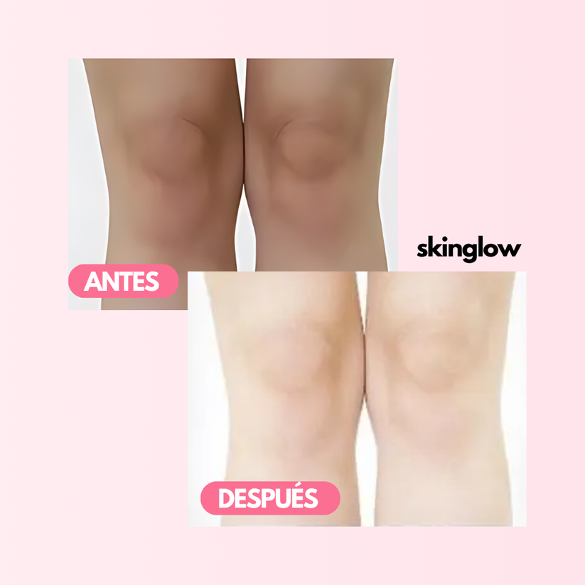 SkinGlow™ CREMA ACLARANTE REVITALIZADORA DE PIEL