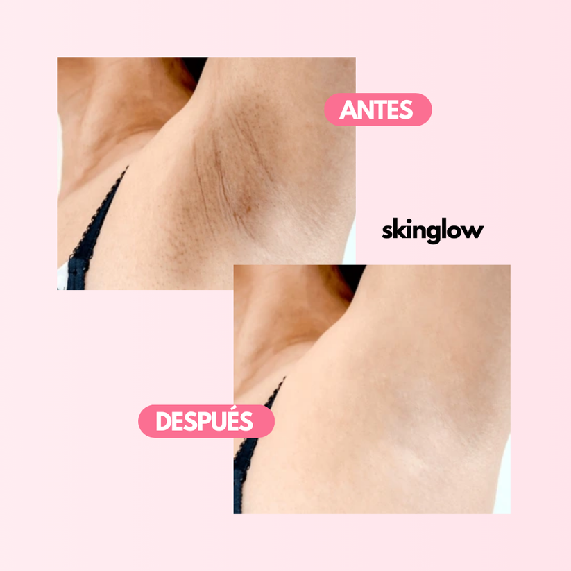 SkinGlow™ CREMA ACLARANTE REVITALIZADORA DE PIEL