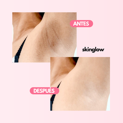 SkinGlow™ CREMA ACLARANTE REVITALIZADORA DE PIEL